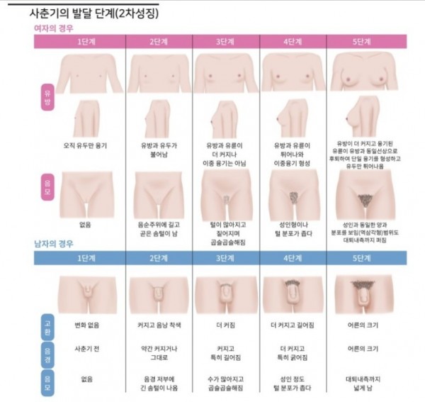 성조숙증과_가슴멍울에_대한_오해와_진실3탄3.jpg